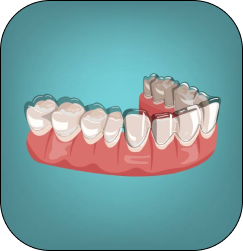 Orthodontic illustration